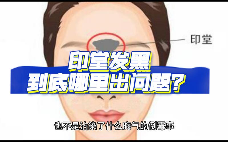 怎么看印堂发黑(印堂发黑暗示什么？如何保健？)